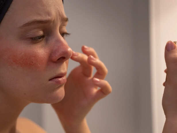 Warning Signs of a Damaged Skin Barrier