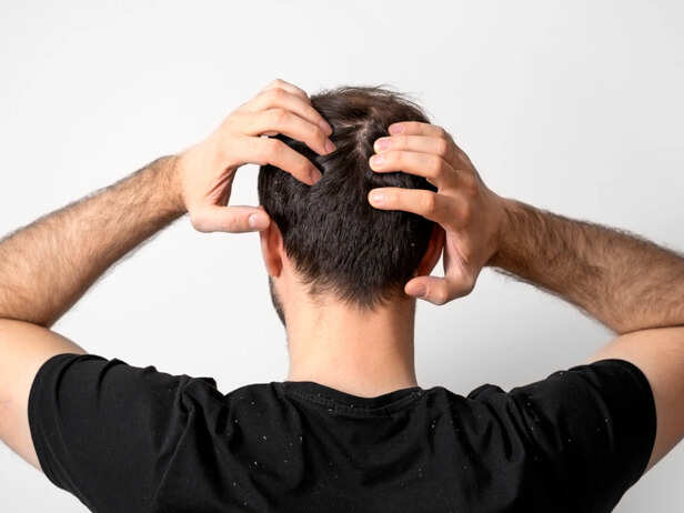 Ever wonder Why Humidity Makes Your Scalp Itchy