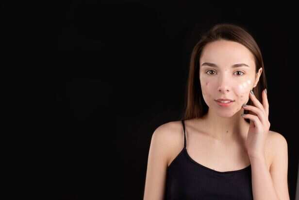 The Common Signs of Oily Skin During the Rainy Season