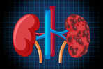 Can Alcohol Really Help Remove Kidney Stones? Here's the Medical Answer