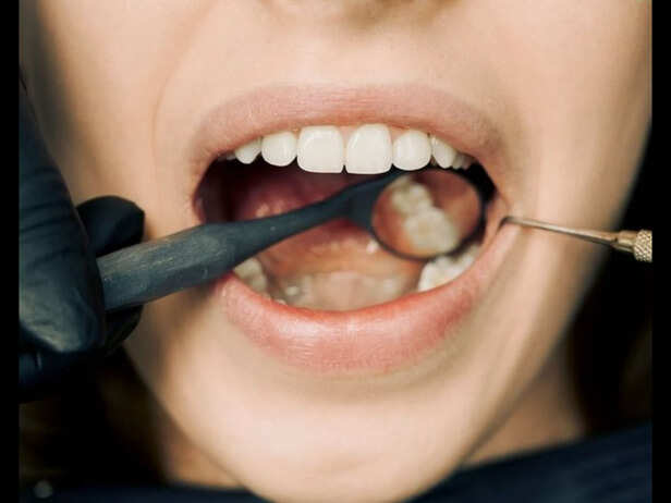 ​Teeth and Gum Structure​