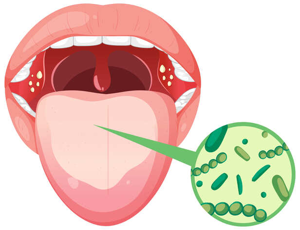 Your Tongue Can Reveal Hidden Health Clues