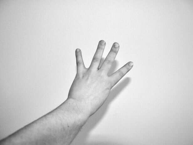 ​Will humans eventually lose their pinky fingers and small toes?