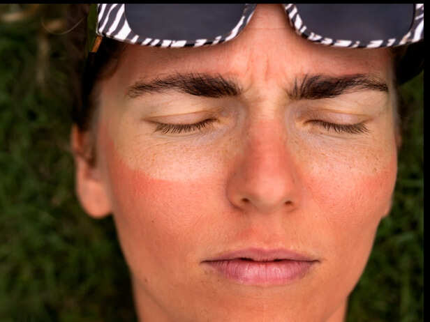 Skin Tone Shifts Before Spots Ever Appear