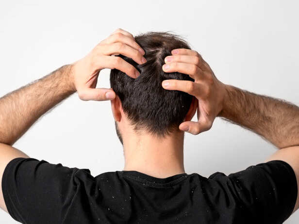 A Healthy Scalp Is Where Shine Starts