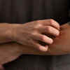 A Calmer Rash Doesnt Mean Its Healing