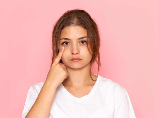 Cholesterol Deposits Around the Eyes