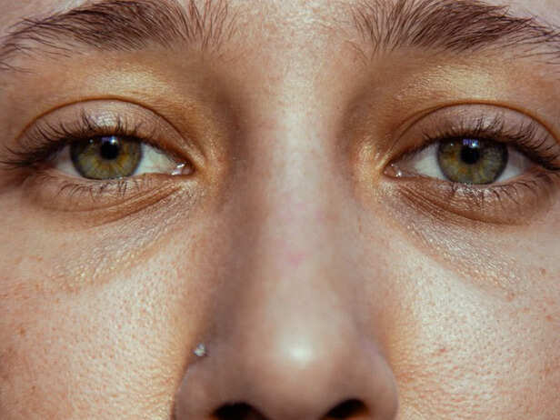 Natural Skin Is Becoming More Acceptable
