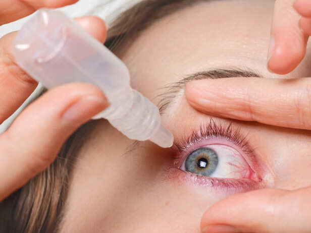 Eye Flu