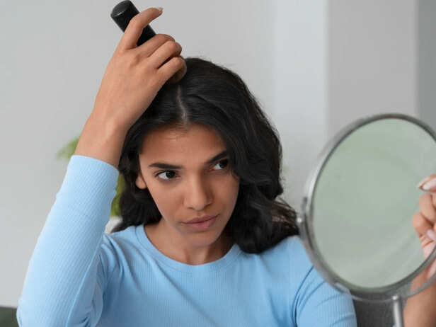 Dandruff Is Not Dirty Hair