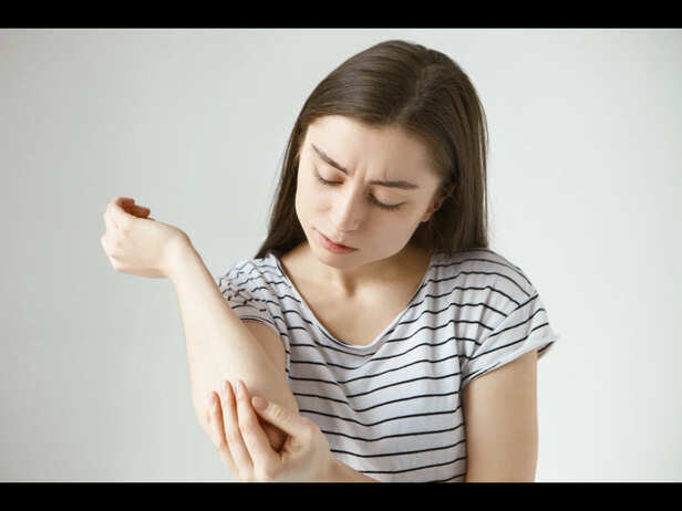 Understanding Eczema