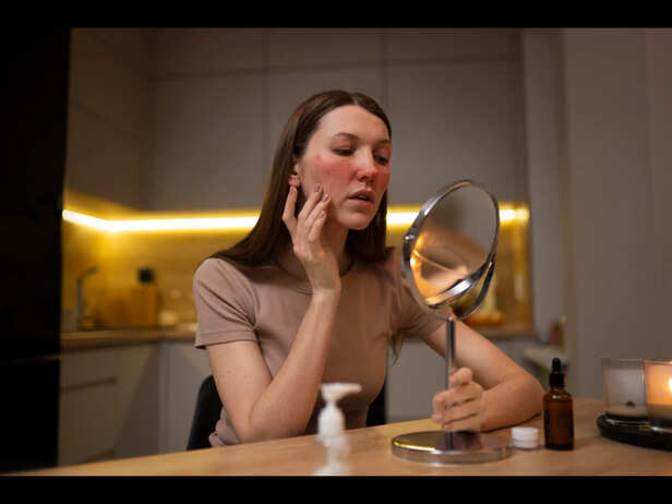 Monsoon Acne Care