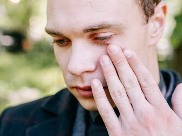 Allergy-Related Eye Puffiness