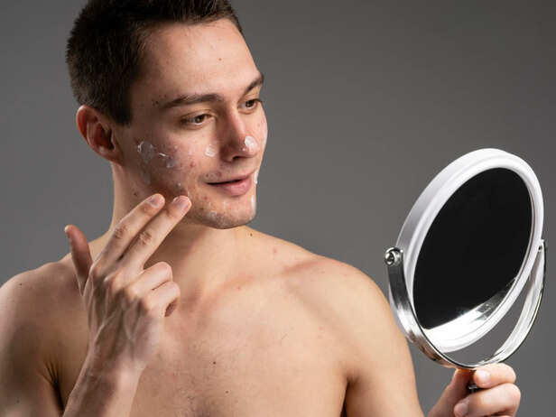 Understanding What Young Skin Needs