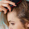 Hot Weather, Different Scalp