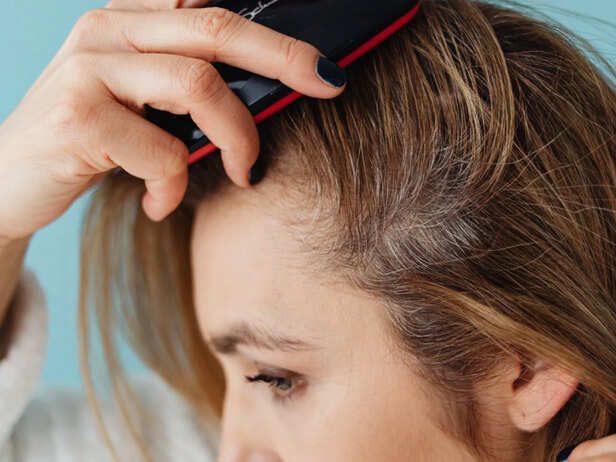 Hot Weather, Different Scalp