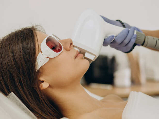 Laser Hair Removal Treatment