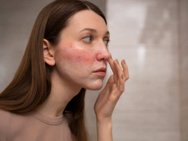 Skin Boosters Carry Real Injection Risks