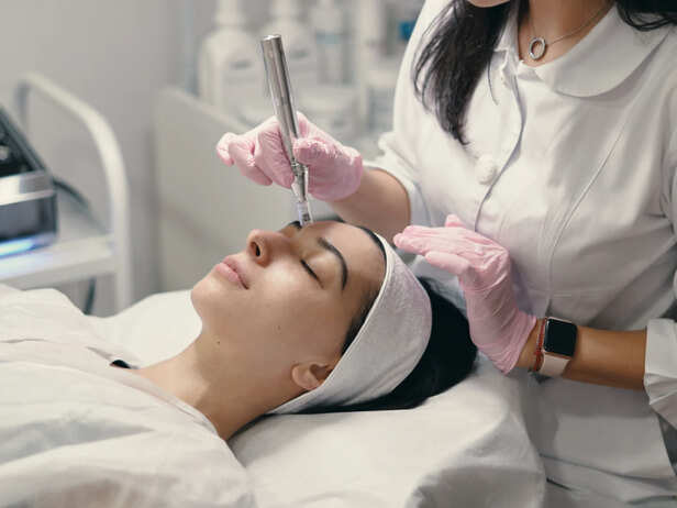 Microneedling Triggers Your Skin's Own Repair