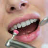 Cleaning Between Teeth