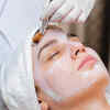 Chemical Peels Aren't One-Size-Fits-All