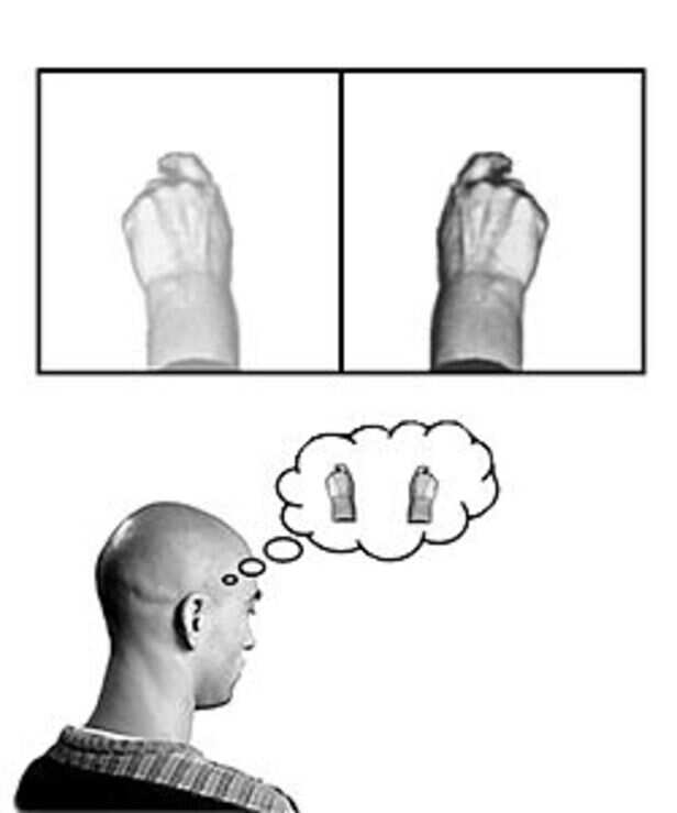 Mirror Therapy - Physiopedia