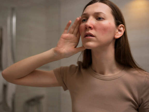 Skin redness and sensitivity