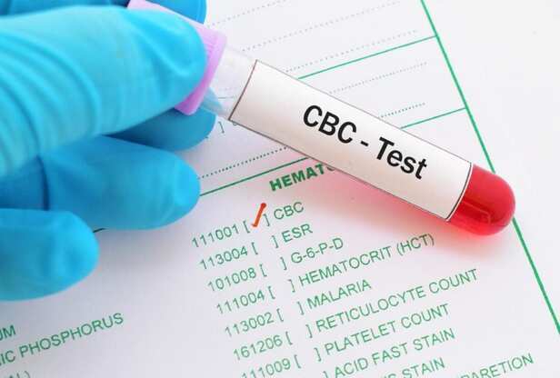 CBC Test at Aarogyam | Aarogyam