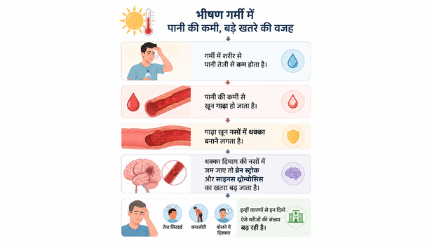 severe-heat-wave-causes-blood-clotting-brain-stroke-2026-05-21-08-56-33