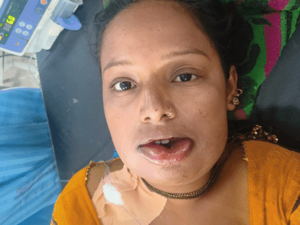 राखी को हल्दी लगाने के बाद होंठों पर सूजन आ गई। सांस लेने में भी तकलीफ होने लगी।