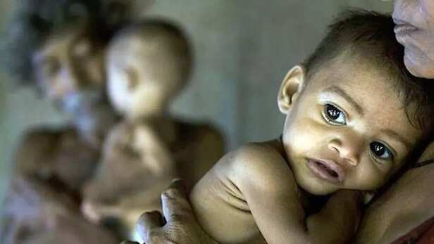 Malnourished children in MP