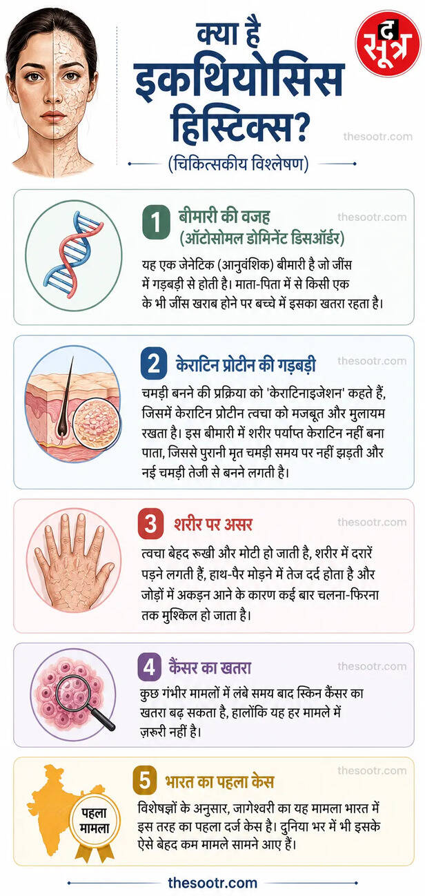 क्या है इकथियोसिस हिस्ट्रिक्स