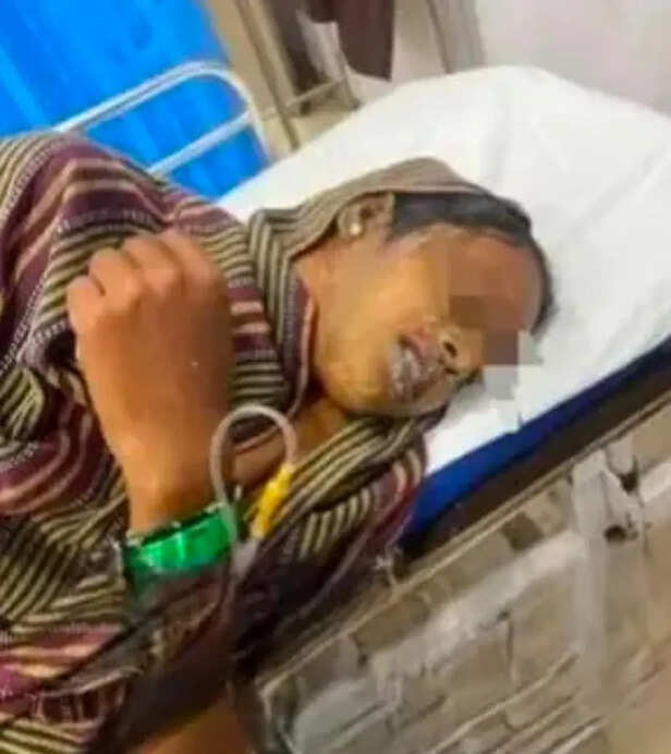 कांवड़ यात्रा में एसिड अटैक