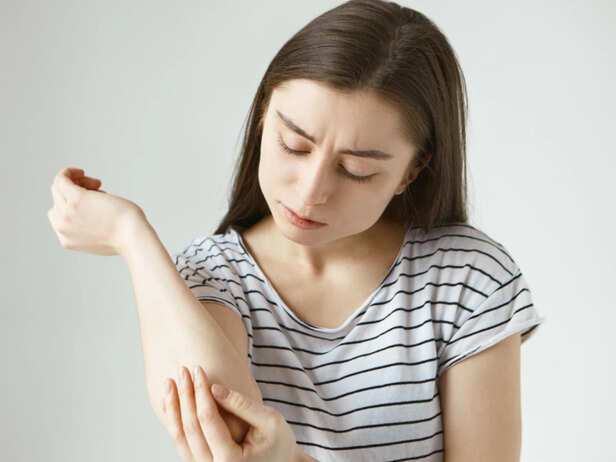 Fungal skin infection during monsoon