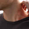 Folliculitis on skin