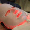 LED Skin Treatment