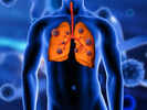 3 Warning Signs Your Lungs May Not Be Healthy
