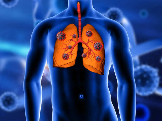 Lungs