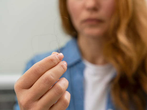 Hair Loss Was Just the Start? The Nail
