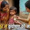 धार में 25 हजार बच्चे कुपोषण से जूझ रहे, 5 हजार अति गंभीर श्रेणी में | 25 Thousand Children in Dhar Suffering from Malnutrition, 5 Thousand in Severe Category