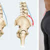 posture correction