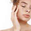 Melasma