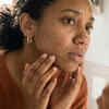 Monsoon Skin Trouble? The Truth About Fungal Infections