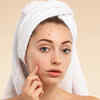 Toothpaste on Pimples? The Skincare Hack That Can Backfire
