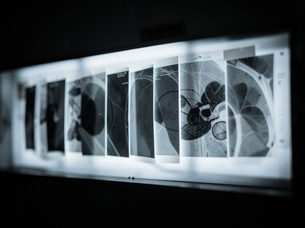 Abstract Radiology Film Study
