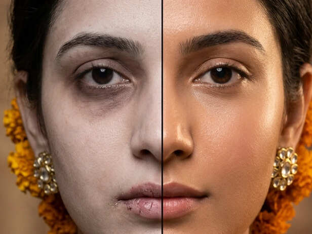 Can low iron affect skin